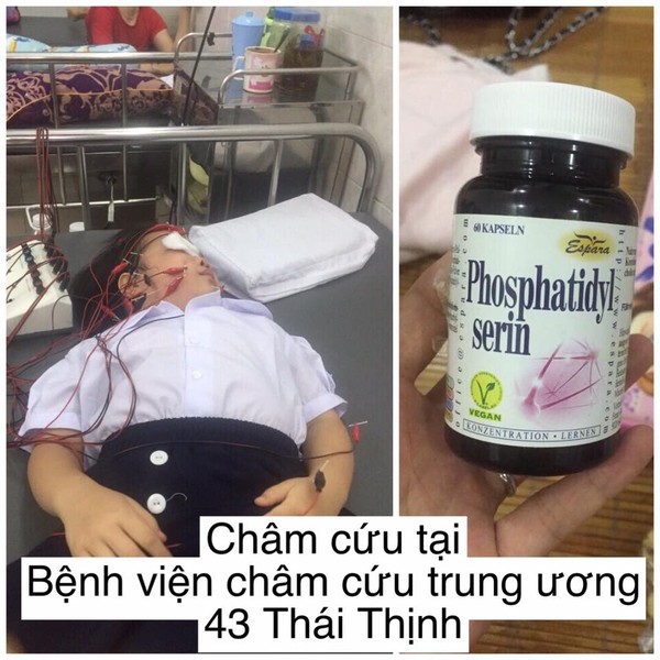 Viêm dây thần kinh ngoại biên số 7