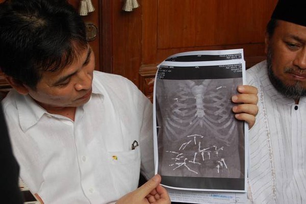 Sống sót với những thứ kỳ lạ trong cơ thể 2 Sống sót với những thứ kỳ lạ trong cơ thể 2