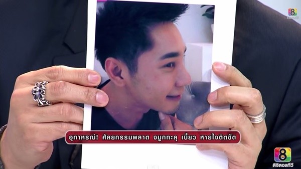 Cặp đôi Thái Lan bị biến dạng mũi do phẫu thuật thẩm mỹ hỏng 8