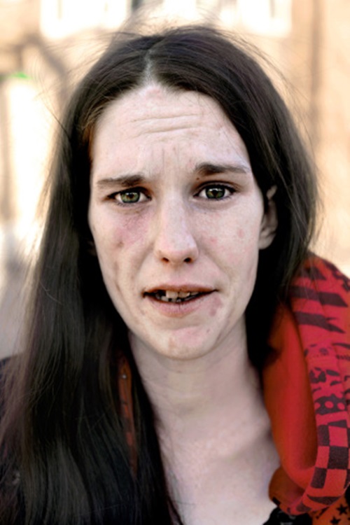 Bộ ảnh về một cô gái trẻ nghiện heroin khát khao tìm lại cuộc sống 12