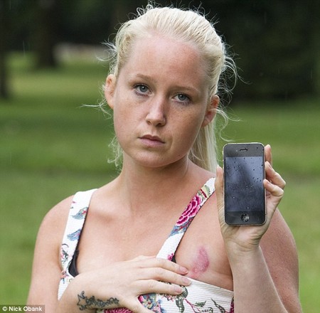 Cô gái tố bị iPhone lỗi làm bỏng, để lại sẹo vĩnh viễn trên mặt 2