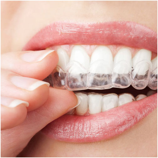 6 vấn đề khó chịu về răng miệng và cách khắc phục 3