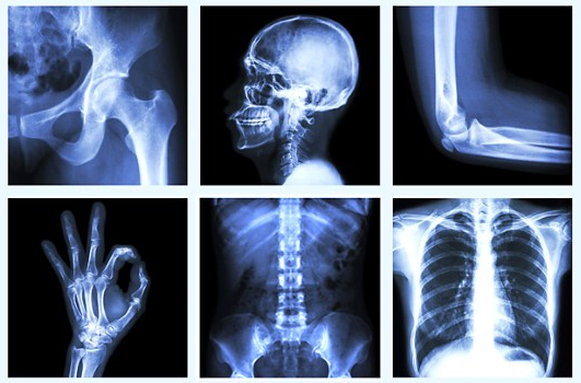 6 điều về sức khỏe của xương không phải bác sĩ nào cũng nói cho bạn biết 1 6 điều về sức khỏe của xương không phải bác sĩ nào cũng nói cho bạn biết 1