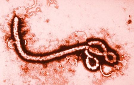 WHO khuyến cáo người khỏi bệnh Ebola kiêng sex trong 3 tháng 1