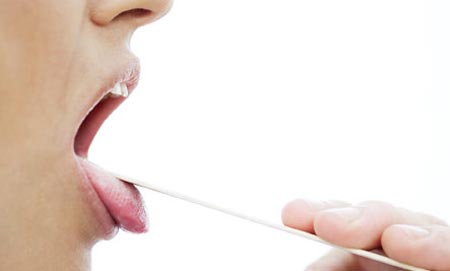 Đoán bệnh của bạn qua những biểu hiện ở lưỡi 1