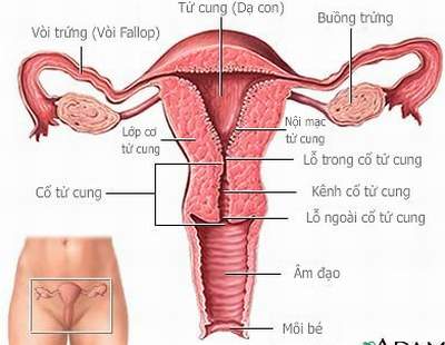 bất thường cổ tử cung gây vô sinh