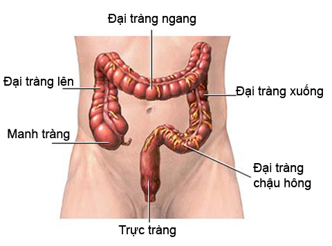 ung thư trực tràng 