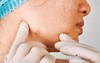 3 loại "mụn" này trên cơ thể có thể là ung thư, dù nam hay nữ, ở độ tuổi nào cũng đừng bỏ qua