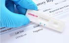 F0 thấy miệng có "vị lạ" hậu COVID-19: Đây là nguyên nhân chính xác nhất và 7 cách giải quyết để đánh bay triệu chứng