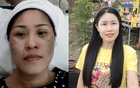 Hành trình lột xác từ "mặt đen tối sầm" thành "mặt hoa da phấn" của người phụ nữ 40 tuổi sau 3 năm từ Điện Biên về Hà Nội