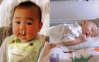Mùa "nghẹt mũi" đã đến, mẹ cần tránh những sai lầm này và 5 cách giúp bé dễ thở tức thì!