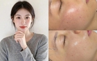 Tôi đã tìm ra cách "bơm" collagen cho da căng mướt tới độ không ai ngờ đã 35 tuổi