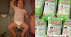 Check tã quần Bobby Antimos: Xoa dịu nỗi bất an của mẹ bỉm có con không đáp ứng thuốc hạ sốt Paracetamol