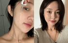 5 lọ serum thu nhỏ lỗ chân lông thực sự hiệu quả
