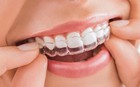 Những lưu ý đặc biệt khi niềng răng để khỏi 'tiền mất tật mang'