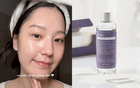 5 lọ toner cực tốt cho da dầu: Đa năng từ kiểm soát bã nhờn tới thu nhỏ lỗ chân lông