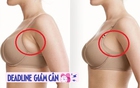 Phụ nữ sau tuổi 40 có nhiều mỡ nách chỉ cần 1 chiếc dây để thực hiện 6 động tác: Đảm bảo sớm gọn đẹp như được hút mỡ nách