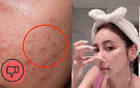 5 bước skincare kiềm dầu giúp da thoáng mịn cả ngày, nàng da dầu đừng bỏ lỡ!
