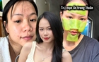 Trị mụn ẩn, thâm mụn trong 1 tuần, cô nàng dùng chiêu đơn giản đến không ngờ