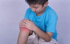 Bé 6 tuổi bị viêm mủ khớp gối và viêm xương tủy sau va đập: BS cảnh báo chấn thương kín của trẻ có thể tiềm ẩn nhiều nguy cơ hơn bố mẹ nghĩ