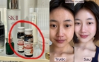 Bổ sung collagen suốt 1 năm và đây là điều đã thay đổi trên gương mặt tôi 