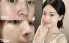 Không chạy theo xu hướng da "trắng sứ", tuổi 35+ tôi nhận ra rằng chỉ cần dưỡng đúng cách thì da sẽ sáng mịn từ bên trong