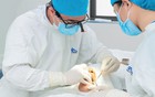 Top 8 các hãng implant uy tín tại Việt Nam
