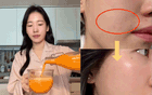 Chống già ở tuổi ngoài 35: Mỗi ngày uống một cốc nước màu cam được ví như "vitamin C trẻ hóa" làn da