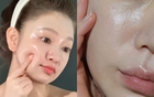 3 dấu hiệu rõ rệt cho thấy bạn đang bị "thất thoát" collagen