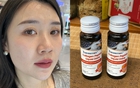 Tôi đã 39 tuổi nhưng da vẫn săn chắc nhờ 7 năm uống collagen