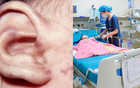 Bệnh do não mô cầu có tỷ lệ mắc thấp, tại sao vẫn dễ xảy ra bùng phát? Bác sĩ Bệnh viện Nhi Trung ương lý giải