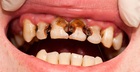 Trẻ thiếu canxi thường phát ra 5 tín hiệu: Bệnh viện Nhi đồng 2 cảnh báo đừng chủ quan