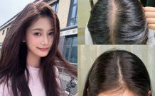 5 xịt mọc tóc "made in Vietnam" để tóc chắc khỏe từ gốc, không lo gãy rụng