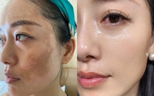 Phụ nữ ngoài 40 đang truyền nhau kiểu dưỡng da mặt nhìn căng bóng và ít chảy xệ hơn