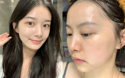 5 lọ serum đêm kích hoạt "công tắc trẻ hóa làn da", tái tạo collagen ngay trong giấc ngủ