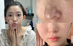 Không cần ra spa, có 5 cách làm sạch sâu lỗ chân lông tại nhà để da láng mịn từ bên trong