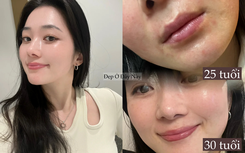 Ngoài 30 da còn đẹp hơn tuổi 20, tôi làm đúng 5 điều này mỗi ngày để "lão hóa ngược"