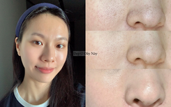 Lỗ chân lông không biến mất, nhưng tôi đã khiến chúng "nhỏ lại" thấy rõ nhờ đúng 2 thứ