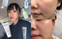 Chỉ 4 bước dưỡng da mỗi tối: Tôi "cứu vớt" được làn da khô căng, nếp nhăn li ti trở nên căng mịn