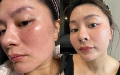 Tôi từng “ném tiền qua cửa sổ” vì mê spa, cho đến khi nhận ra: Chỉ cần 3 phút đắp lotion mỗi ngày, da cũng có thể đẹp lên