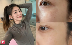 5 serum mờ nám "made in Vietnam" được nhiều chị em khen nức nở