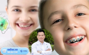 BS khoa Răng Hàm Mặt chỉ ra những trẻ nên niềng răng và vì sao cần niềng răng sớm