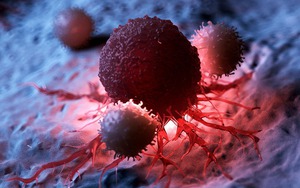 Ung thư 'gõ cửa' sau nhiều năm duy trì 2 thói xấu