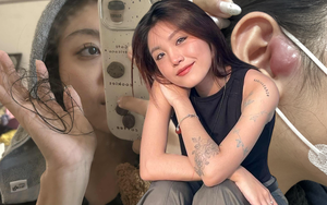 Hai th&aacute;ng trước khi qua đời, người phụ nữ đ&atilde; kiệt sức cả thể chất lẫn tinh thần: L&agrave;m sao để ph&acirc;n biệt giữa 