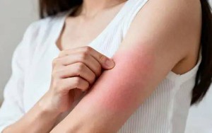 5 người đàn ông cùng mắc ung thư ruột, 7 tháng sau tái khám khiến bác sĩ ngỡ ngàng: 