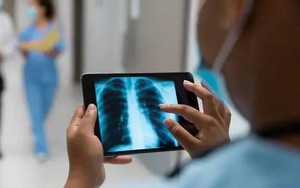 Lượng đường trong máu của một phụ nữ 50 tuổi đã giảm từ 16 xuống 5,5 trong 6 tháng: Ba thói quen hạ đường huyết rất đáng học hỏi - Ảnh 3.