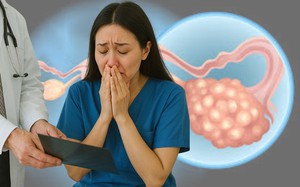 Tự hào về sức khỏe của mình, nhưng tôi đã bị sốc khi biết minh bị ung thư buồng trứng ở tuổi 40: 2 dấu hiệu cảnh báo đã bị tôi bỏ qua