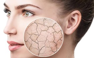 Bí quyết chống khô da hiệu quả trong mùa thu