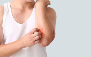 Trước Tết, tôi học cách giữ sức: Bài học của một phụ nữ 35+ từng 