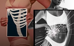 1 loại thức ăn sẽ l&agrave;m cho t&igrave;nh trạng da sần vỏ cam tồi tệ hơn! B&aacute;c sĩ da liễu chỉ c&aacute;ch cải thiện da cam ngay tại nh&agrave; kh&ocirc;ng cần thẩm mỹ - Ảnh 5.